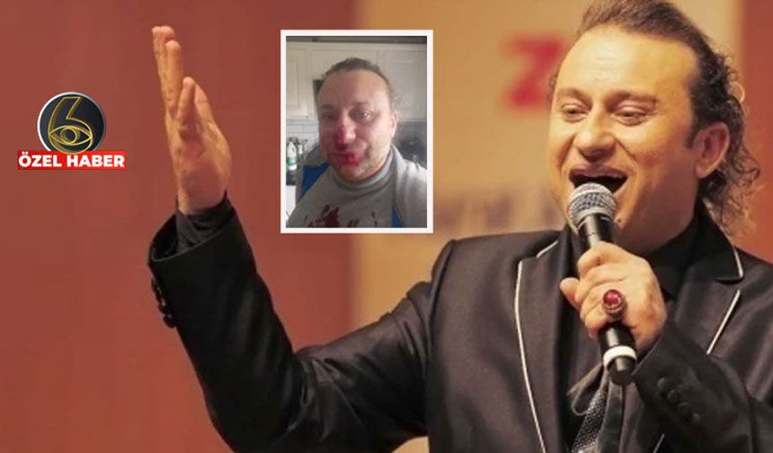 Başıboş köpek saldırısı sonrası entübe edilen Onur Akay’ın kardeşi son durumu açıkladı