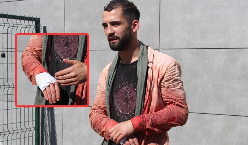 Acemi kasaplar sahnede! "13 dakikada keserim" dedi, herkes donup kaldı