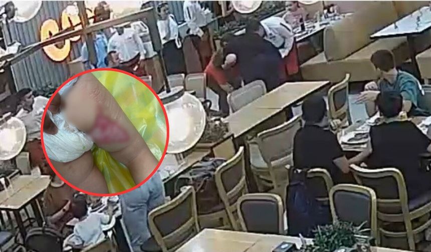 Restorandaki şov faciayla bitti! Yemek kâbusa dönüştü