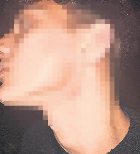 Istanbul Erkek Lisesi Akran Zoraşığı