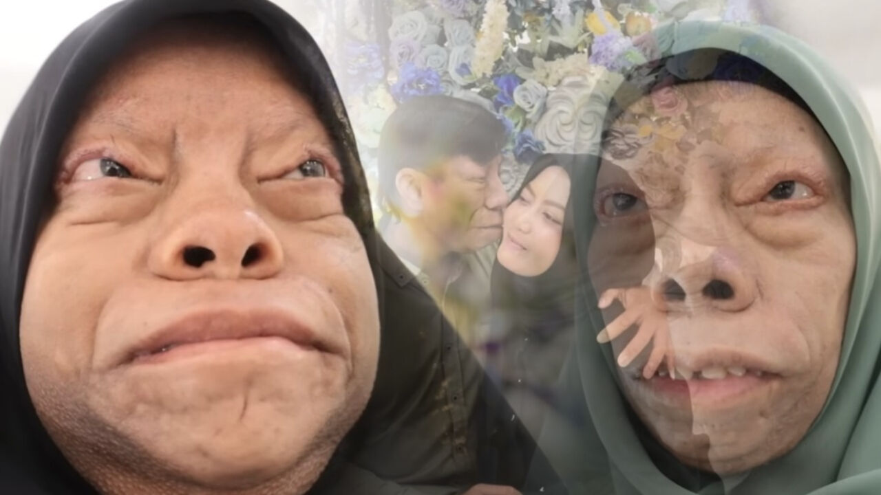 Tiktok 'kertenkele suratlı' ailenin hayatını değiştirdi! Kimse onlara yaklaşmazken gerçek aşkı bakın nasıl buldu!