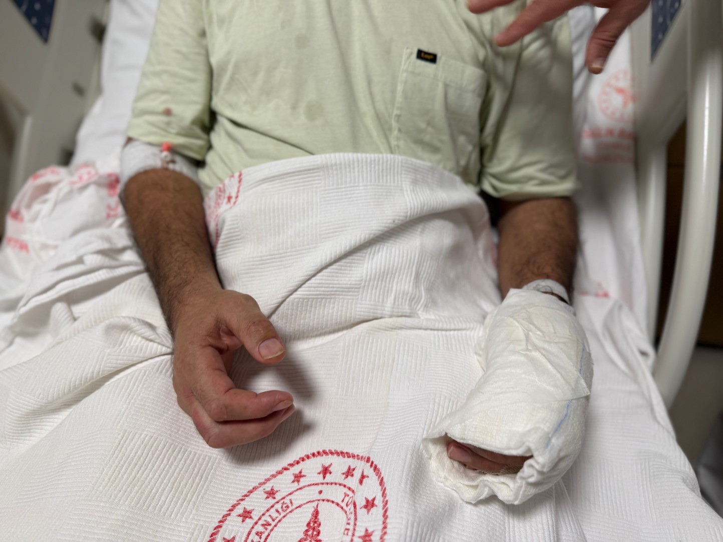 Sicak Su Torbasi Patladi Vücudunun Yuzde 30U Yandi 2