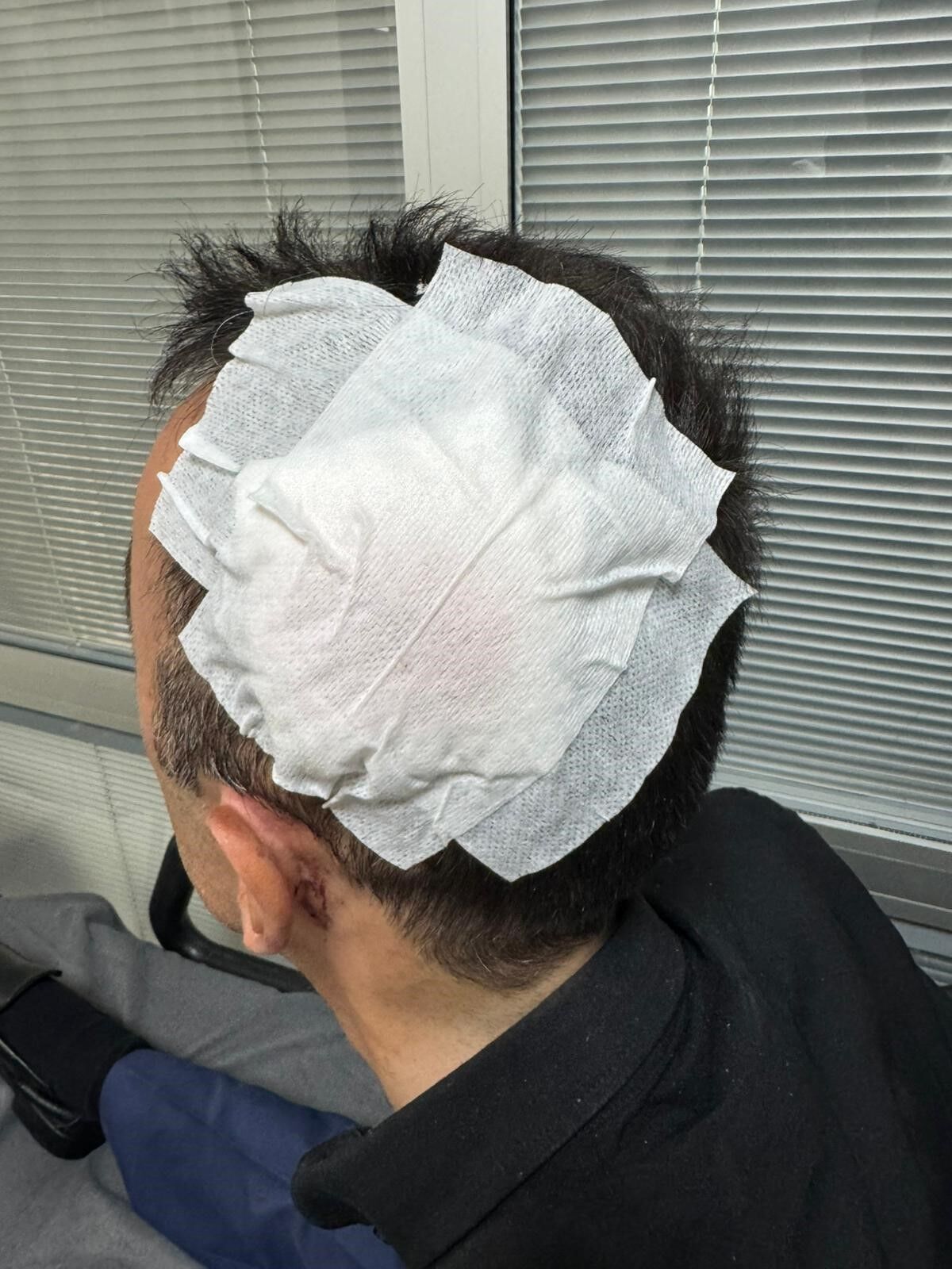 Engelliye Çarpan Ehliyetsiz Sürücüye 15 Bin Tl Ceza (2)