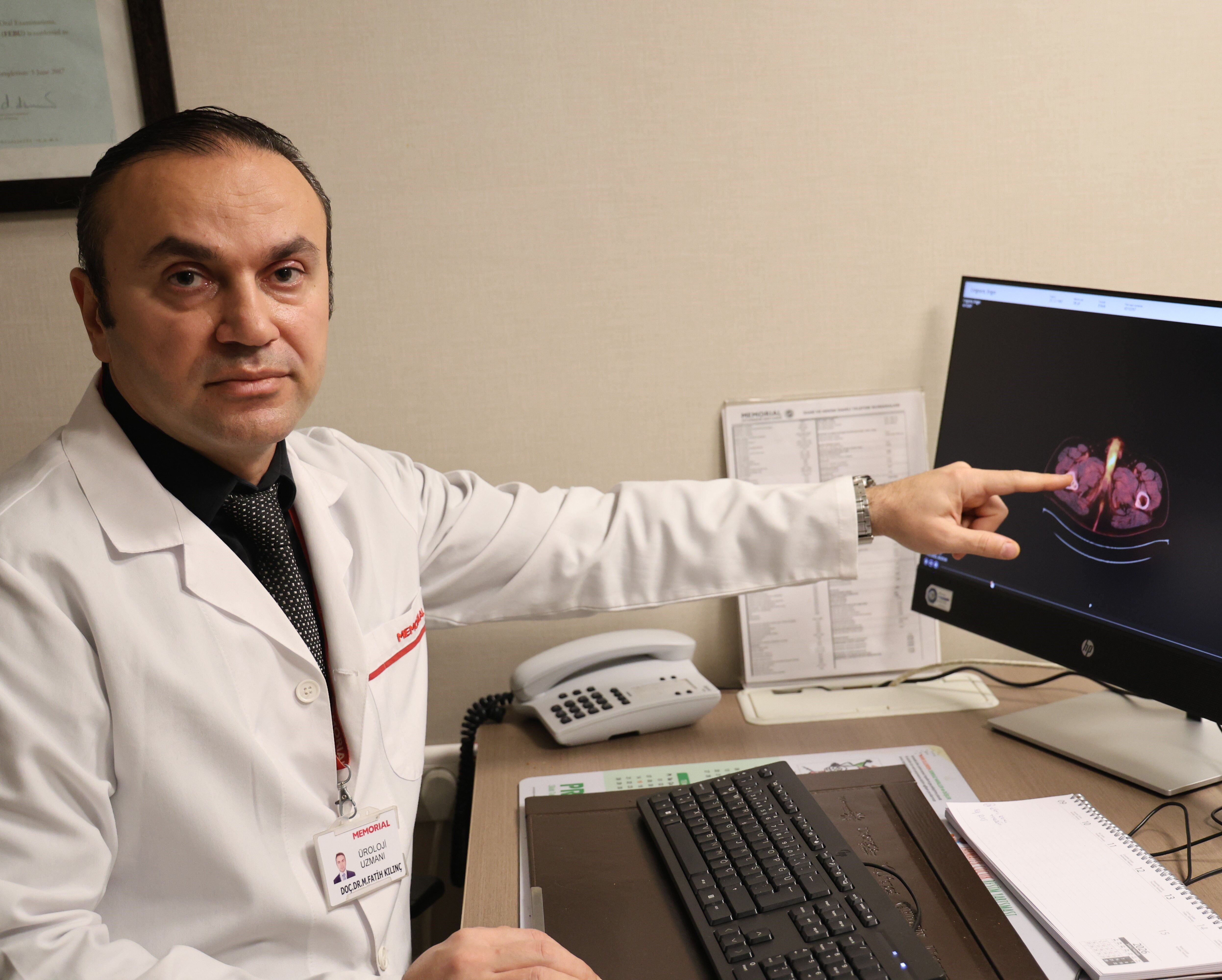 Uzuv Kaybi Yaşadi Ama Hayat Kali̇tesi̇ Yükseldi̇