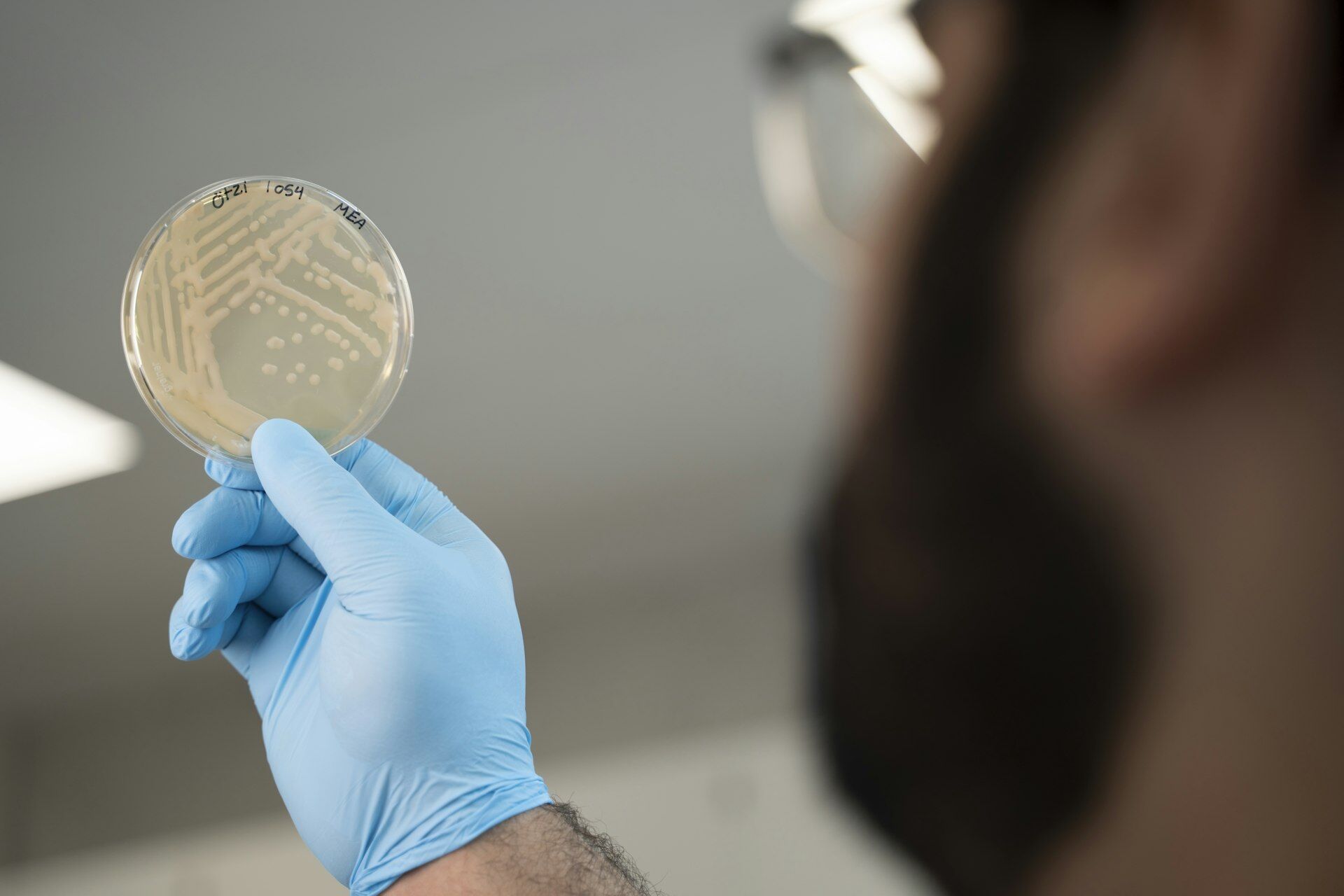 Otzi Yeasts 00